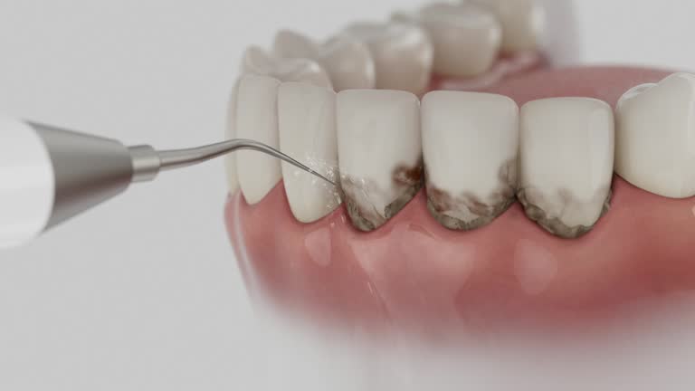 Trusted Dental Implants service in New Market, VA - Dentist Open Now